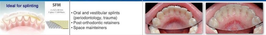 Система шини DENTAPREG SPLINT SFM 422059266 фото