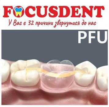 Система шини DENTAPREG BRIDGE PFU 422061483 фото